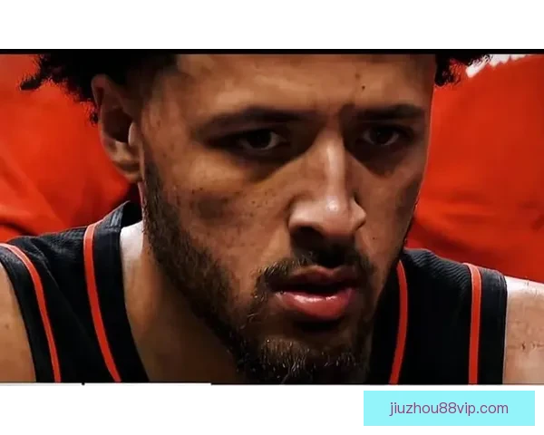 活塞主帅谈坎宁安伤缺：球队责任更重每个人需为球队目标继续努力